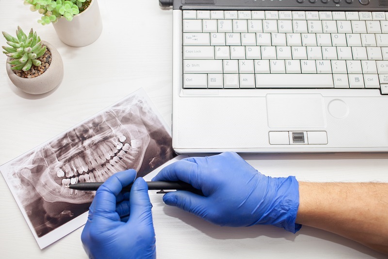 dentist in clinic examines x-ray of jaw of client's patient's teeth. modern technologies. close up